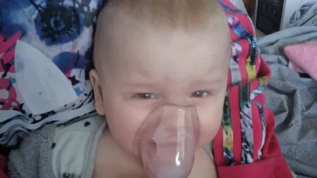 Ukraine_Baby with inhaler over his mouth and nose